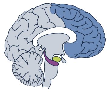 The effects of trauma on the brain are highlighted in three areas in an illustration of the brain